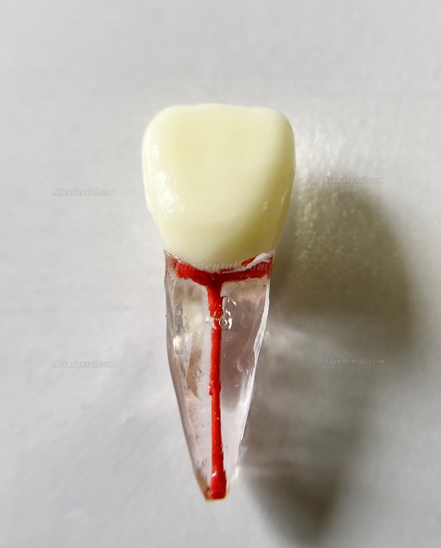 Dental Teeth Model Endo Files Practise Molar Upper Lower Tooth Premolar Root 2/3-Rooted Canal